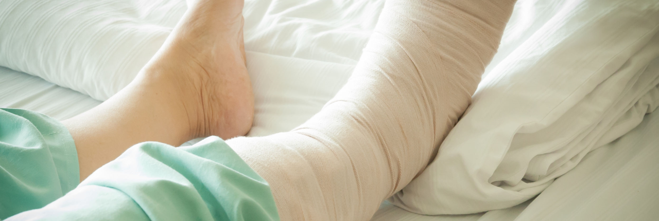 000_injury_types_leg_01